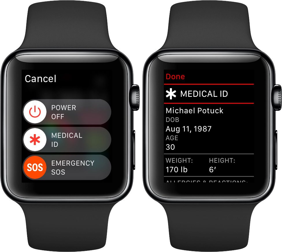 Come accedere alla Cartella clinica/Medical ID su Apple Watch Come accedere alla Cartella clinica/Medical ID su Apple Watch