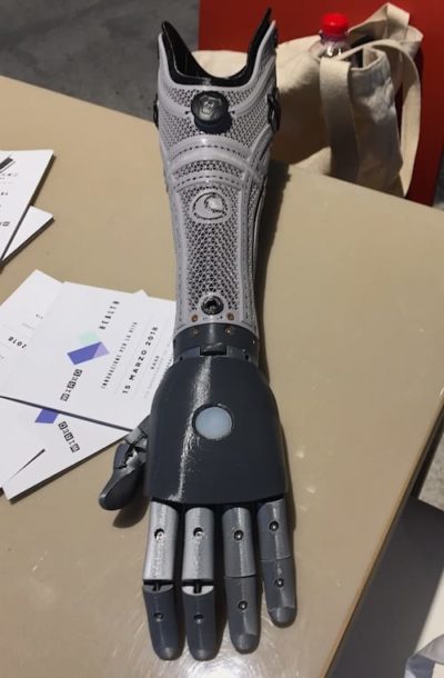 Protesi Bionica Mano Bionica di Open Bionics