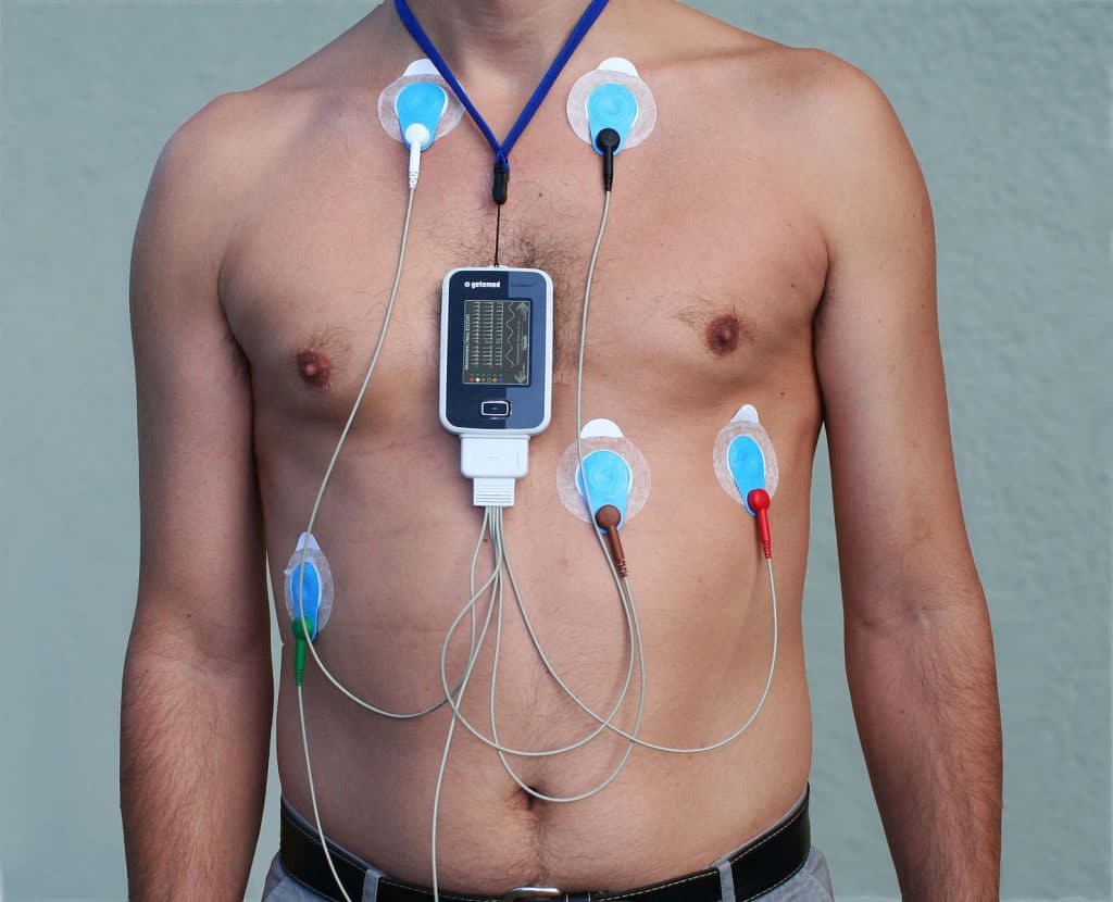 ECG dinamico secondo Holter ECG dinamico secondo Holter