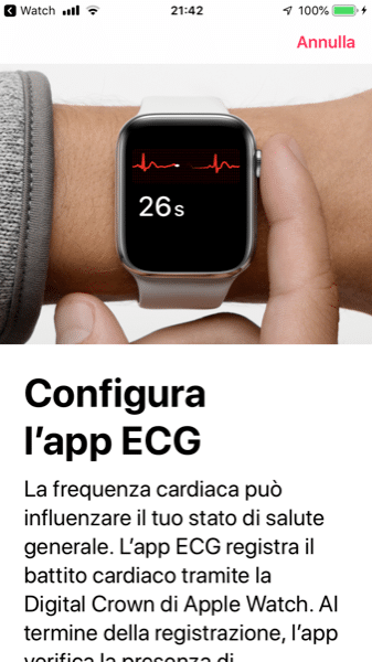 Come Effettuare un ECG sull'Apple Watch Come Effettuare un ECG sull'Apple Watch